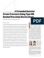 REHABILITACIÓN. Magne Treatment of Extended Anterior Crown Fractures Using Type IIIA Bonded Porcelain Restorations