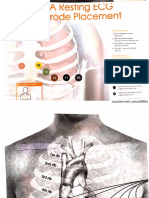 pozitionarea electroziilor pentru EKG