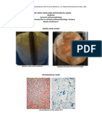 Gross-View Cases and Histological Slides