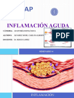 Inflamacion Aguda