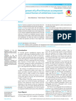 Management of Le Fort II Fracture Accompanied With Blowout Fracture of Orbital Base (Case Report)