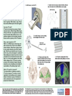 What Is Diffusion Tensor Imaging?: How Does DTI Work?