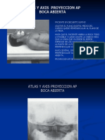 ATLAS Y AXIS  PROYECCION AP Rx