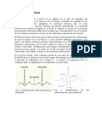 Electrocardiograma