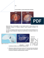 Tipos de Malla para Hernias y Clasificación Según Su Material