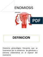 Adenomiosis Diagnosis 40Chars