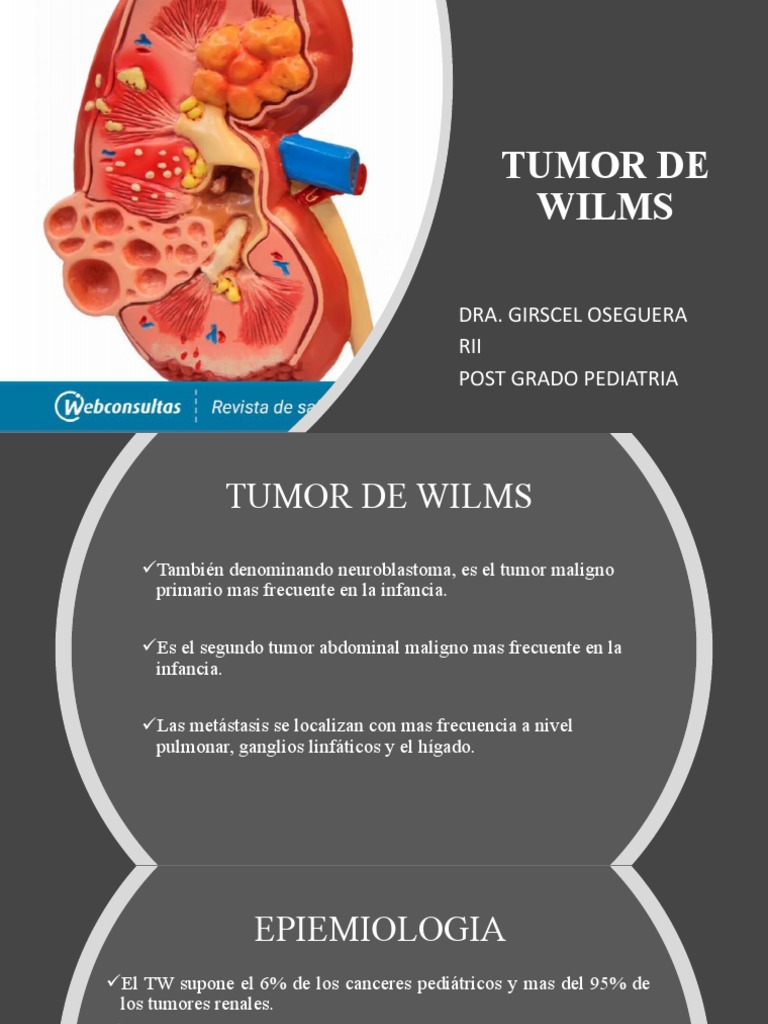 Tumor de Wilms | PDF | Cáncer | Neoplasias