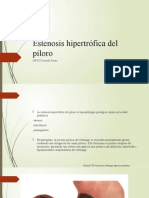 Hipetrofia Congenito Del Piloro