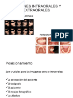 Imágenes Intraorales y Extraorales