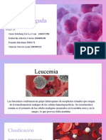 Leucemia Mieloide A