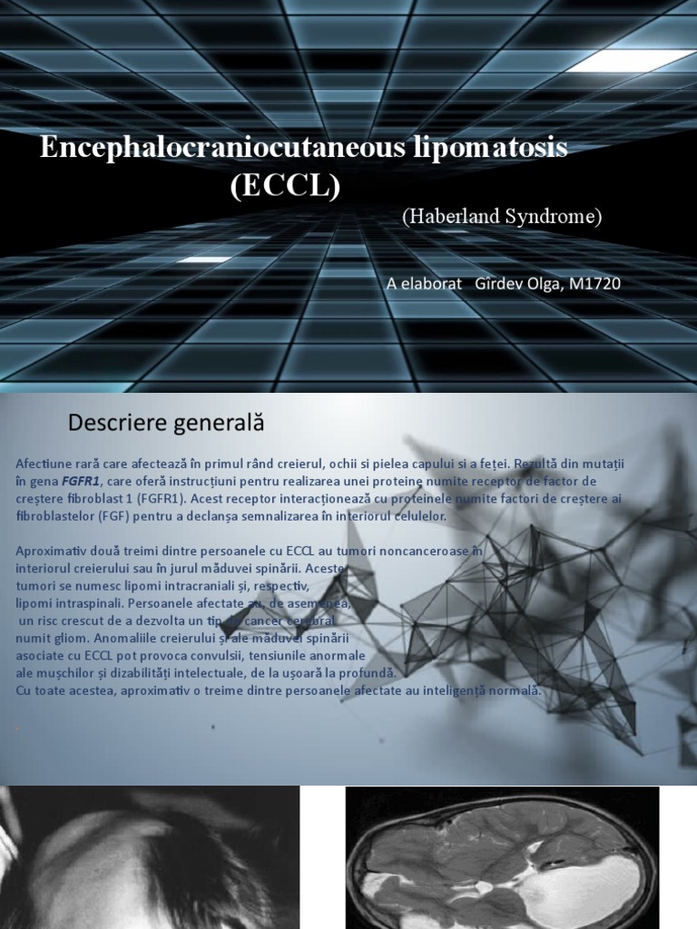 Encephalocraniocutaneous Lipomatosis | PDF