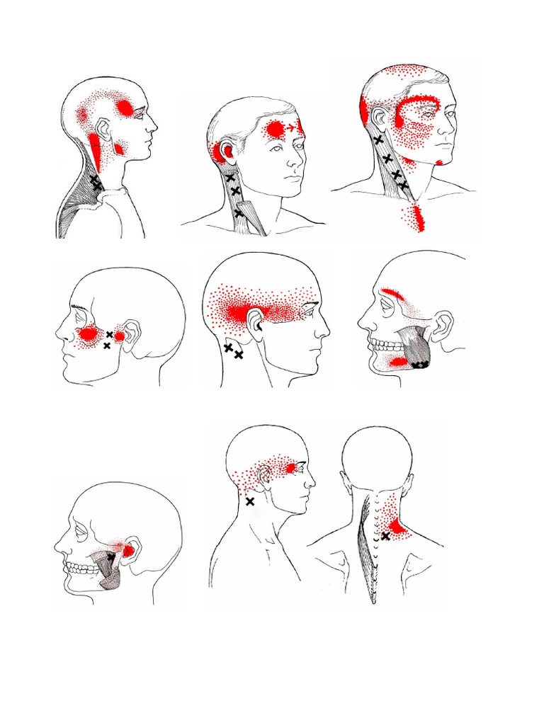 Punti Trigger | PDF