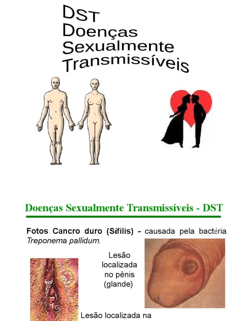 Doenças Sexualmente Transmissíveis: Sintomas e Imagens | PDF | Infecção ...