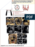 aortic valve ecocardiography