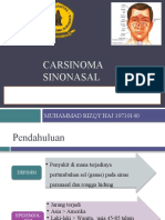 Ca Sinonasal