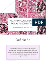 Glomerulonefritis Focal y Segmentaria