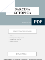 Sarcina-ectopica prezentare