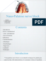 Nasopalatine Nerve Block