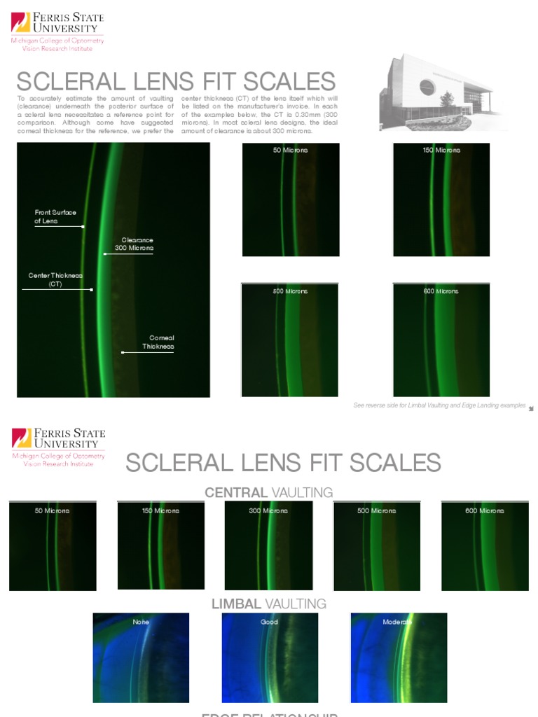 Scleral Lens Fit Scales: 150 Microns 50 Microns | PDF