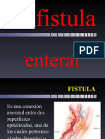 Fistula Enteral