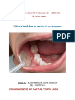 Effect of Teeth Loss On Oro-Facial Environment: Done By: Khaled Hamed Alabd Alahmad ID: 201502300