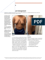 Photo Quiz: Severe Male Breast Enlargement