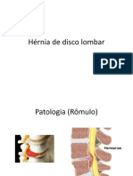 Hérnia de disco lombar - cinesiologia