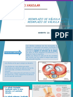 Cirugía cardíaca válvulas