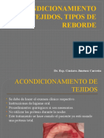 Acondicionamiento de Tejidos, Tipos de Reborde