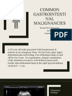 Common Gastrointestinal Malignancies