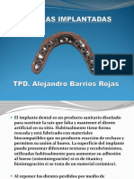 Barras Sobre Implantes ALEX BARRIOS ROJAS