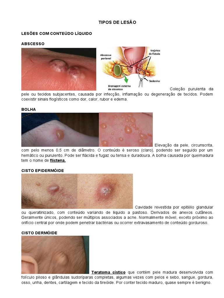Resumo - Dermatologia, PDF, Psoríase