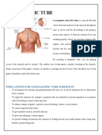 Indications For Nasogastric Tube Insertion