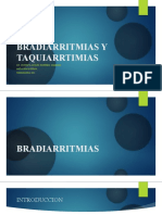Bradiarritmia - Taquiarritmia (Profesor)