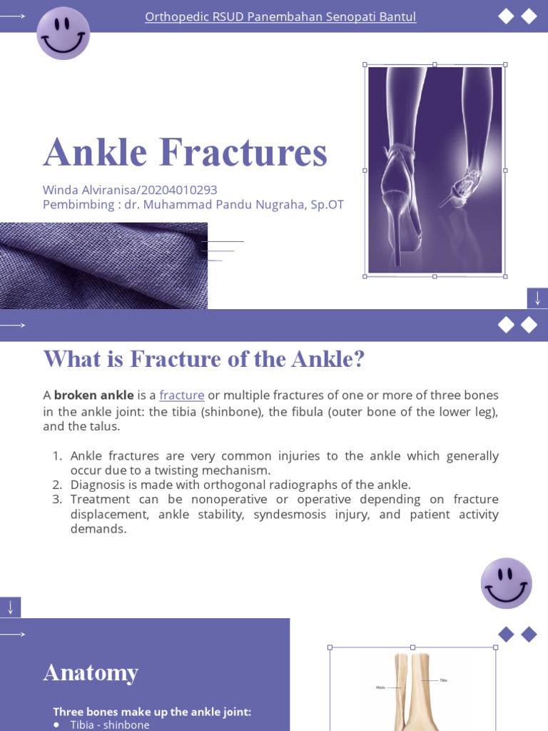 Ankle Fractures: A Comprehensive Review of the Anatomy, Classification ...