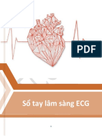 S Tay Lâm Sàng ECG