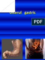Chirurgie Generala Ulcerul Gastric