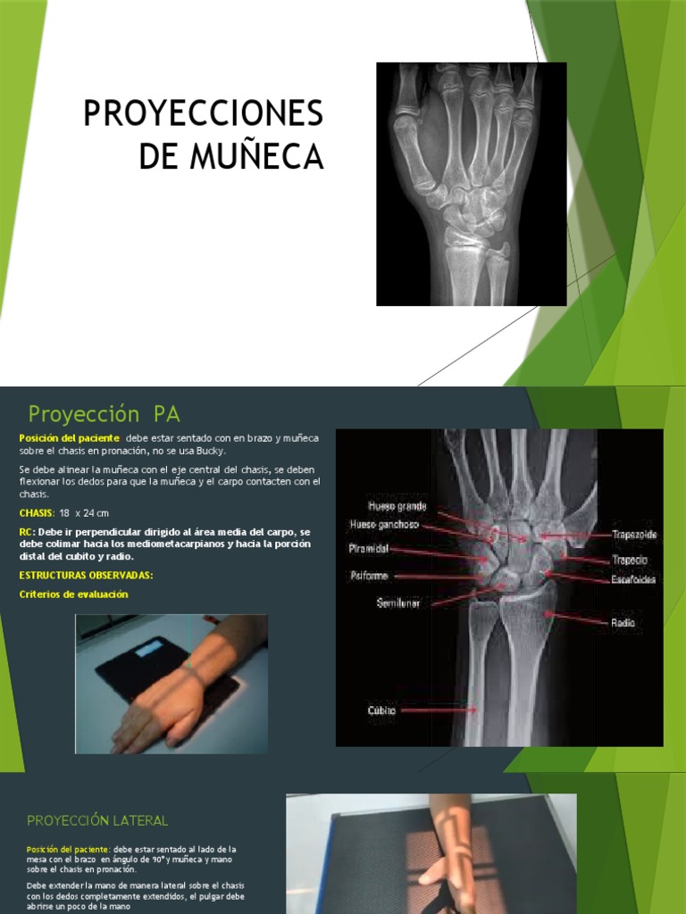 Proyecciones de Muñeca | PDF | Mano | Sistema musculoesquelético