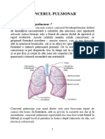 0opmf_Cancerul Pulmonar