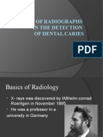 9 Radiographs For Dental Caries