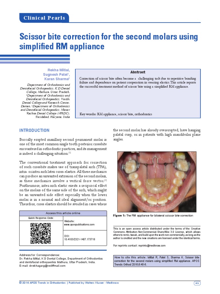 Scissor Bite Correction For The Second Molars Using Simplified RM