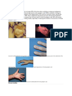 Background: Retinacular Ganglion Transillumination of