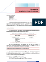 Tipos y características de los bloqueos aurículo-ventriculares