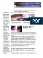 Demodex Treatment Options: Recurrent Inflammation To Eyelids