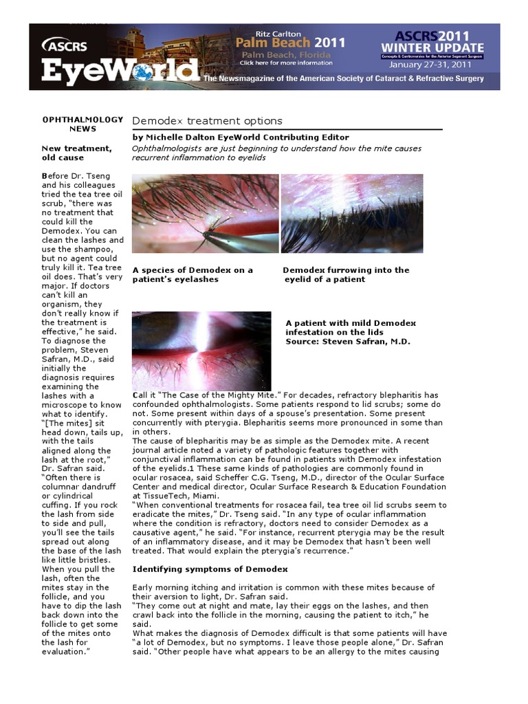 Demodex Treatment Options Recurrent Inflammation To Eyelids PDF Immunology Epidemiology