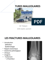 13. Fractures Malléolaires