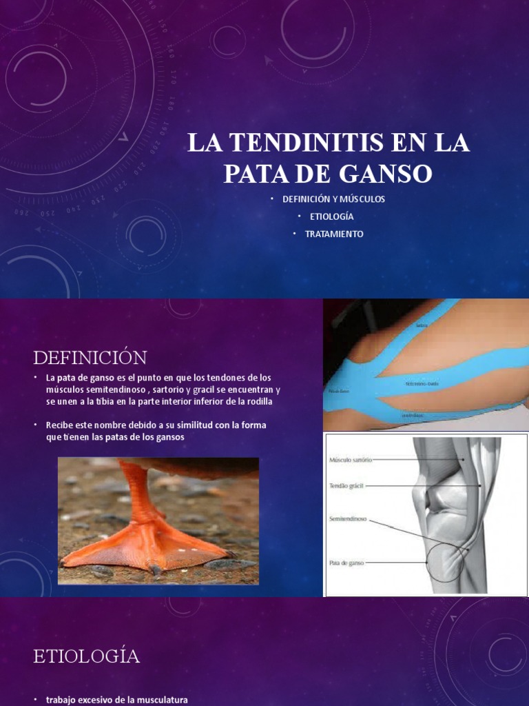 La Tendinitis en La Pata de Ganso | PDF