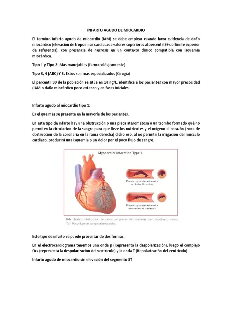 Infarto Agudo de Miocardio Clase 4 | PDF | Infarto de miocardio ...