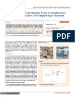 Evaluation of Tomographic Brain Reconstruction Techniques: Case of The Shepp-Logan Phantom