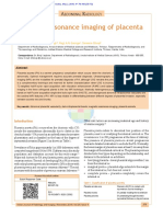 Magnetic - Resonance - Imaging - of - Placenta - Accreta